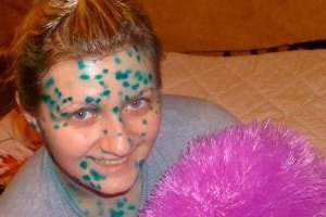 Эти недуги (и еще ряд других) входят в число именно детских инфекционных заболеваний.