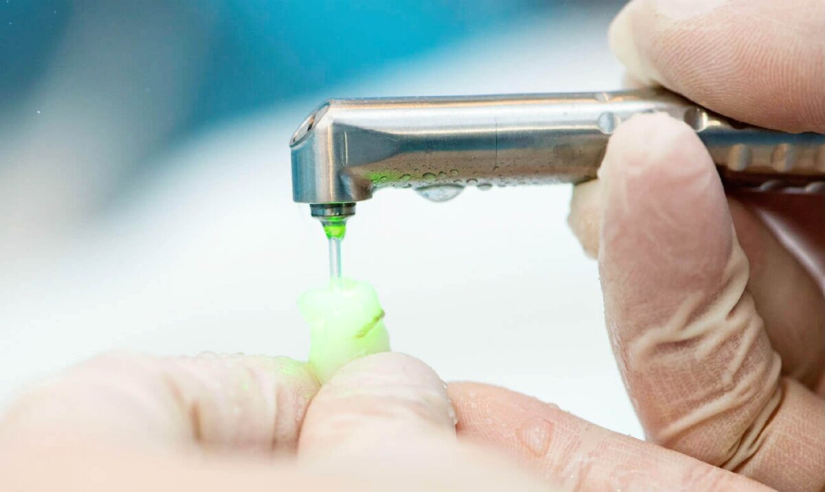 Отбеливание зубов: вред или польза? | Журнал Startsmile о стоматологии ...