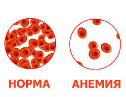 норма и анемия