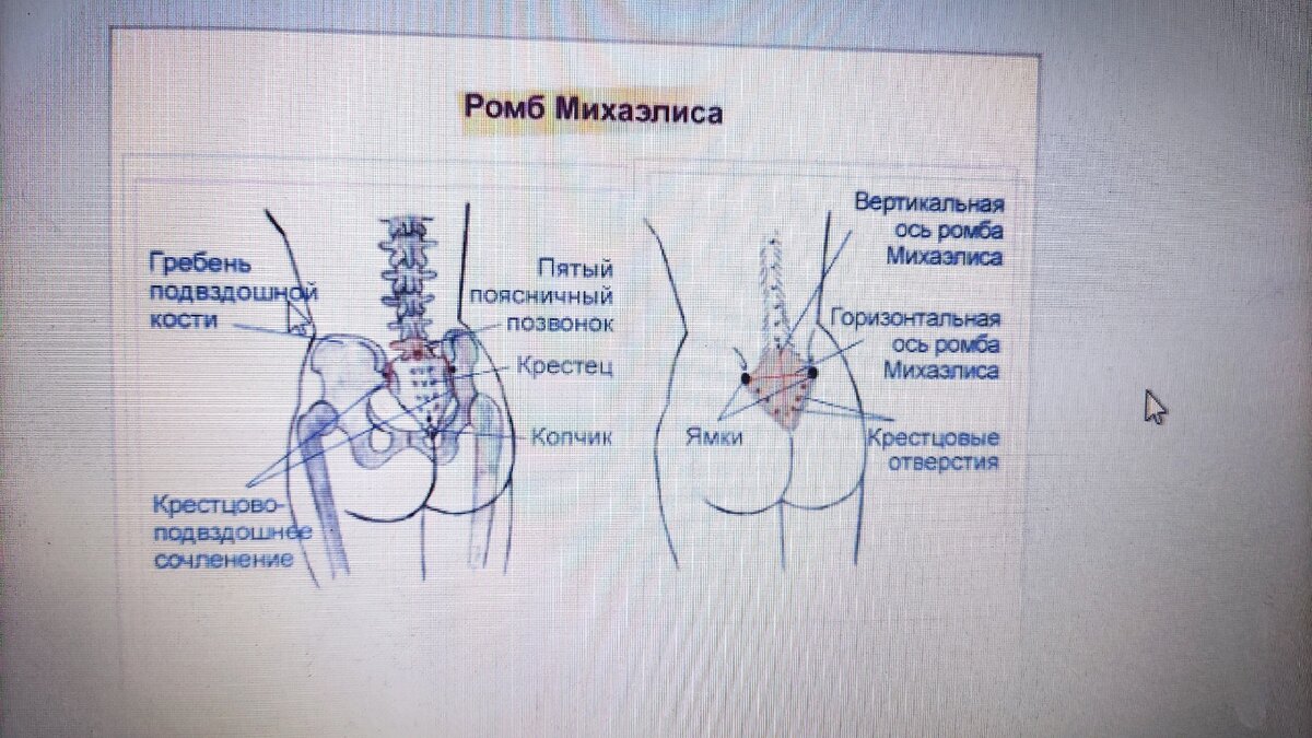 Массаж при бесплодии