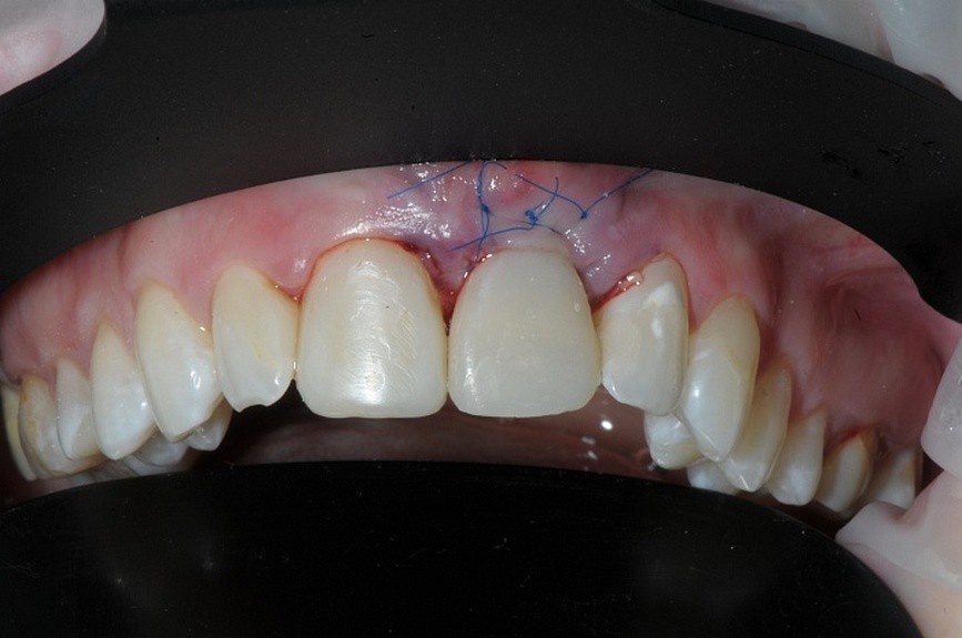 Фото: Стоматологическая клиника «Авантис»