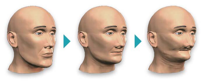 Эффект преждевременного старения. Фото с сервиса Яндекс.картинки