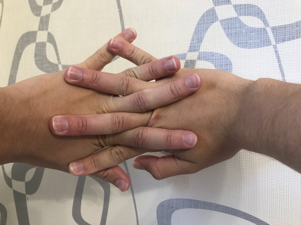 Кольцо и форма пальцев: тест на соответствие