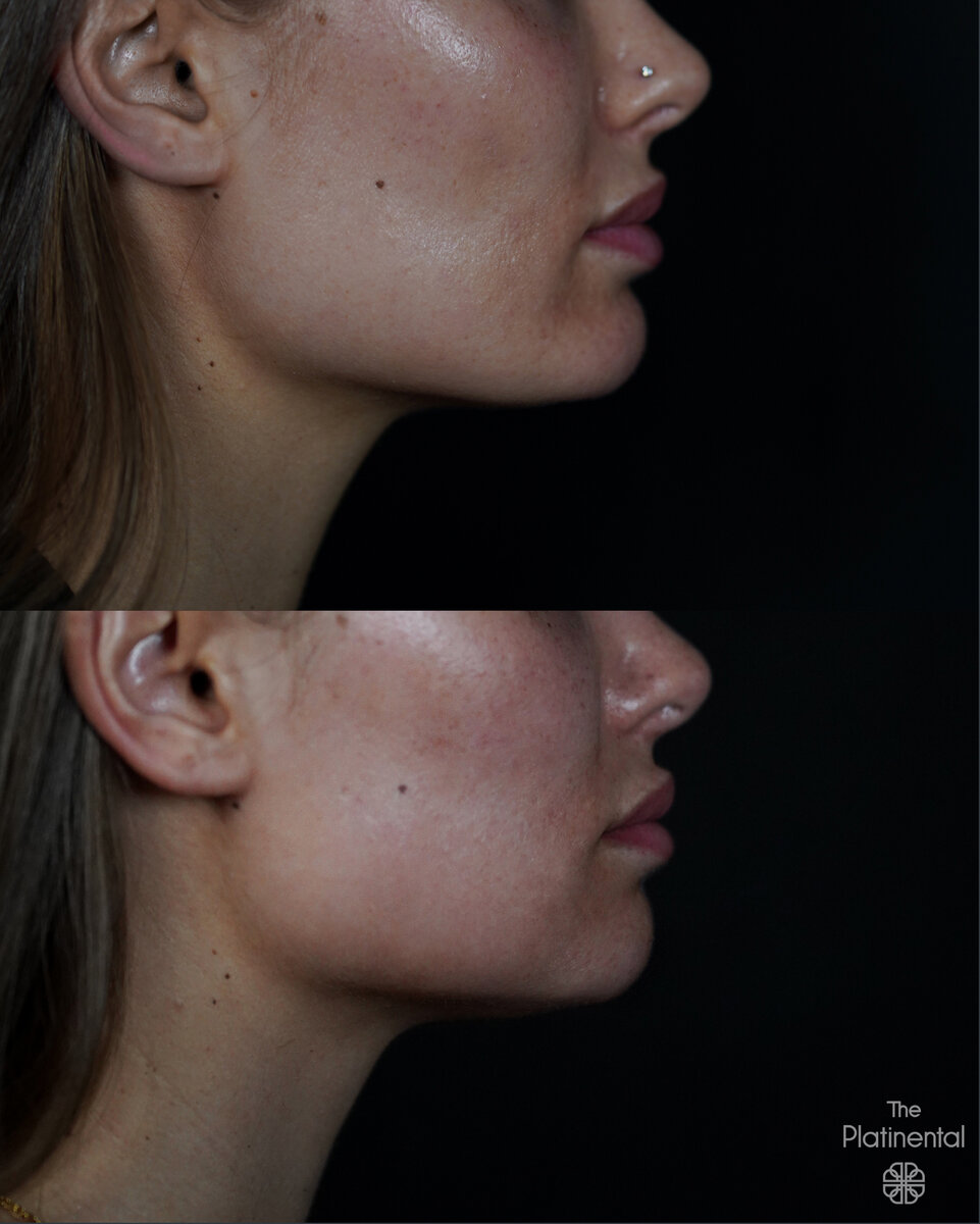 Листайте карусель. Хирург: Вахид Мамедов.