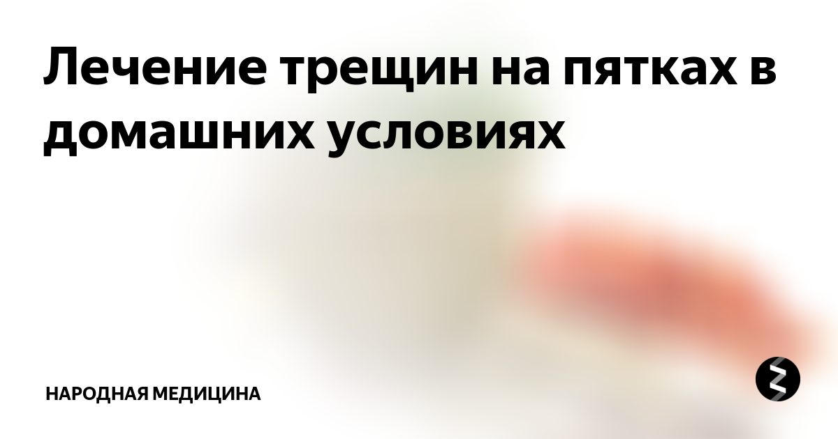 Трещины на пятках - почему возникают и как с ними бороться?