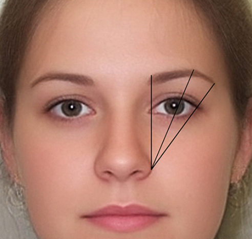 Как уменьшить расстояние между глазом и бровью
