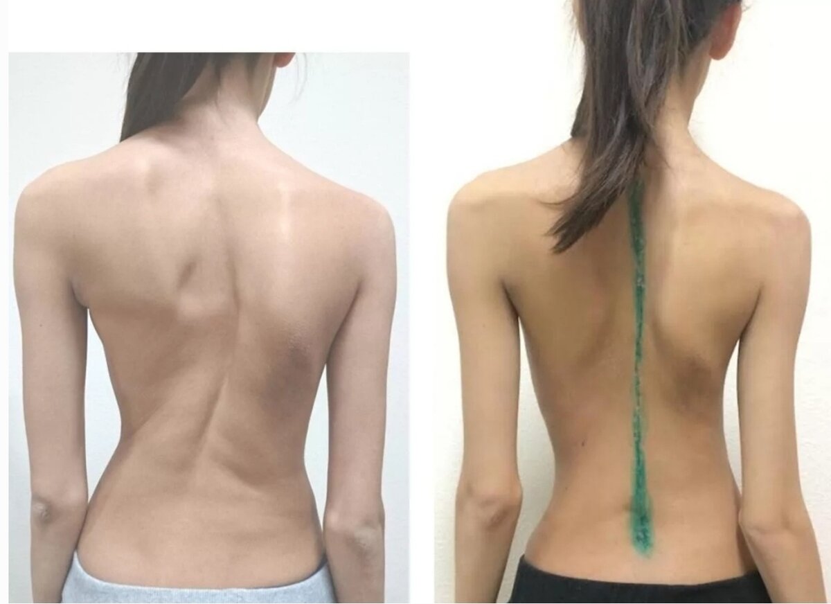 Фото взято в качестве иллюстрации у Яндекс-картинки 