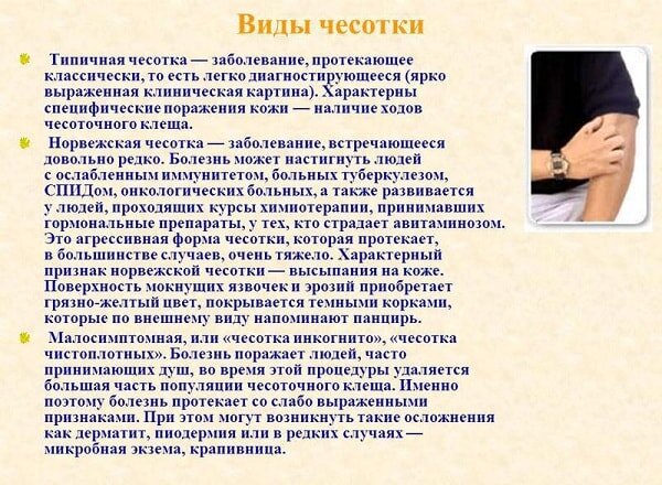 Чесотка - причины появления, симптомы заболевания, диагностика и способы лечения