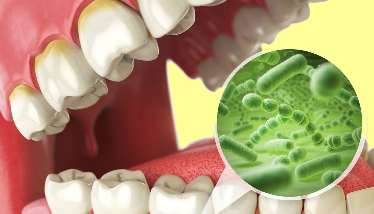 микробы в ротовой полости