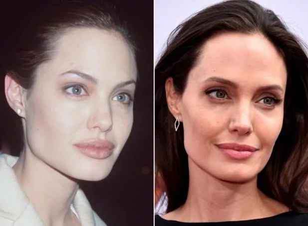 Анджелина Джоли; до и после уменьшения губ