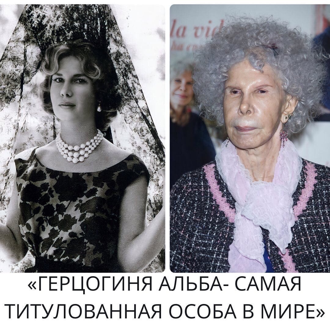 Сегодня Вам расскажем о самой титулованной аристократке (7 титулов герцогини, 23 маркизы и 19 графини). 
Полное имя-Мария дель Росарио Каэтана Альфонса Виктория Евгения Франциска Фитц-Джеймс-Стюарт-и-Сильва.

Каэтана входит в «Книгу рекордов Гиннесса» как самая титулованная особа в мире. В роду герцогини более 50-ти дворянских титулов!

По информации различных источников, с самого детства Альба была дружна с принцессой Лилибет, которая сейчас известна как королева Елизавета II.
В интернете много информации о том, что Королева Великобритании должна при встрече кланяться герцогине Альбе в знак приветствия, однако это не так, ведь титула выше королевского нет.

"Меня отправили в Лондон. Там одним из первых моих ухажёров стал племянник Льва Толстого, великого русского писателя. Граф Толсой был очень красивый, вежливый, приятный и интересный мужчина. Но он не был в моём вкусе... Другим был итальянский принц Аспрено Колонна."-вспоминает в своей автобиографии Альба

Герцогиня славилась своей более чем бурной личной жизнью. Каэтана была замужем три раза и дважды хоронила своих мужей. В браке с Ирухо Каэтана родила шестерых детей: пятерых мальчиков и дочь.

В 2011 году 85-летняя герцогиня удивила общественность - Каэтана вышла замуж за 61-летнего госслужащего Альфонсо Диеса (6 фото). Перед свадебной церемонией женщина отписала все своё состояние (которое оценивается до 3,5 миллиарда евро) детям.

И как сообщает вики, внешность Каэтаны -это результат приобретенной уже в зрелом возрасте болезни гидроцефалии, а не результат многочисленных косметических операций, как принято считать (в других источниках- Альба пыталась исправить последствия другой болезни многочисленными операциями) .

Скончалась 20 ноября 2014 года в Севилье.