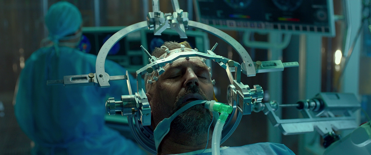 Кадр из фильма Идёт операция на мозге