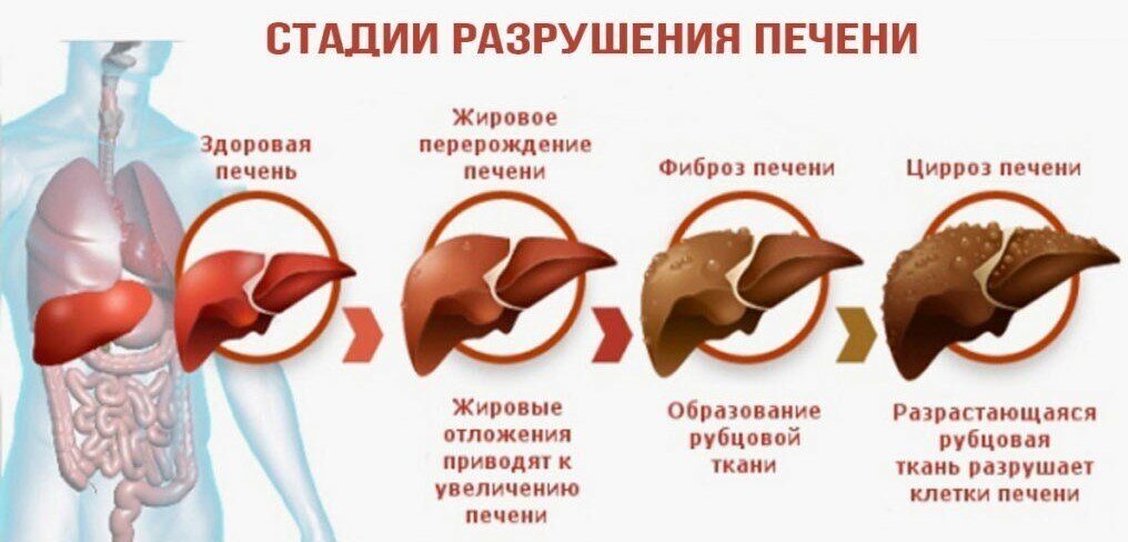 ПРОФИЛАКТИКА ТАБАКОКУРЕНИЯ, АЛКОГОЛИЗМА И НАРКОМАНИИ. ФОРМИРОВАНИЕ ЗДОРОВОГО ОБРАЗА ЖИЗНИ