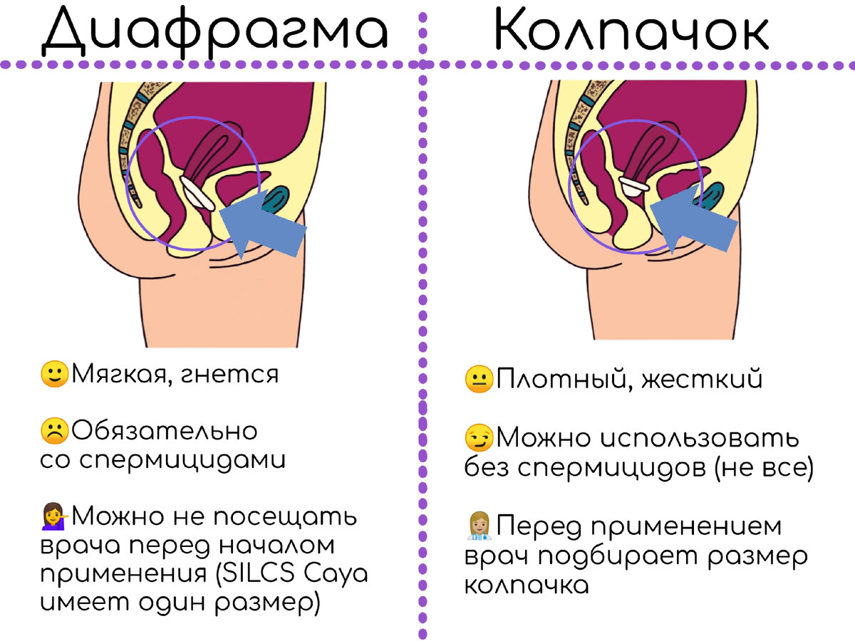 Современные методы контрацепции для женщин и мужчин : ПОЗИТИВМЕД