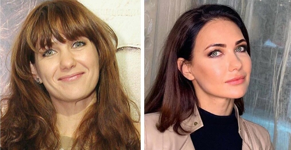 Екатерина климова губы до и после МАГИЯ ЕКАТЕРИНЫ КЛИМОВОЙ ГЛАЗАМИ КОСМЕТОЛОГА ФЛОРЕНЦИЯ I СТОМАТОЛОГИЯ I КОСМЕТОЛ