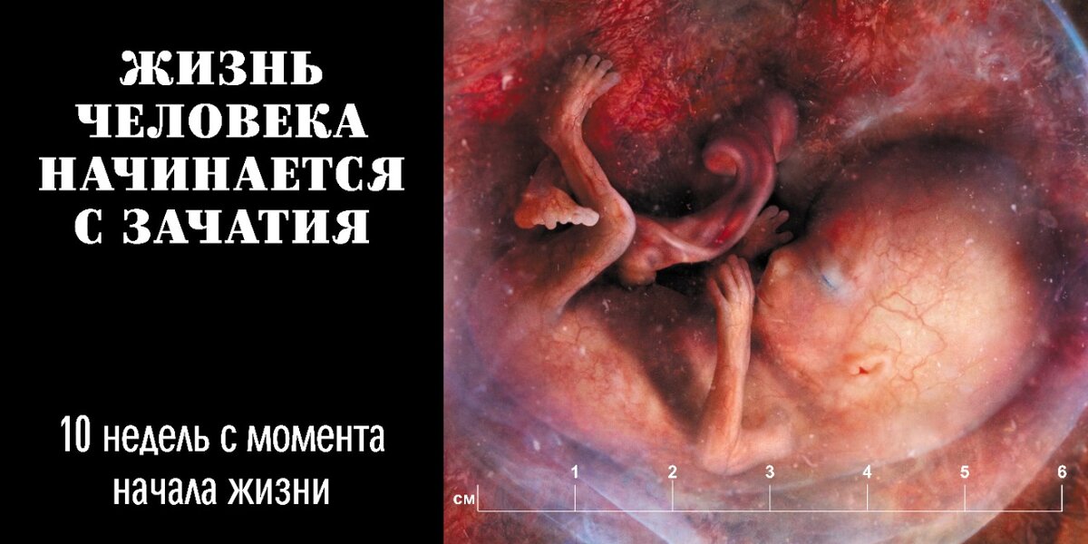 10 недель от начала жизни. Жизнь человека начинается с зачатия!