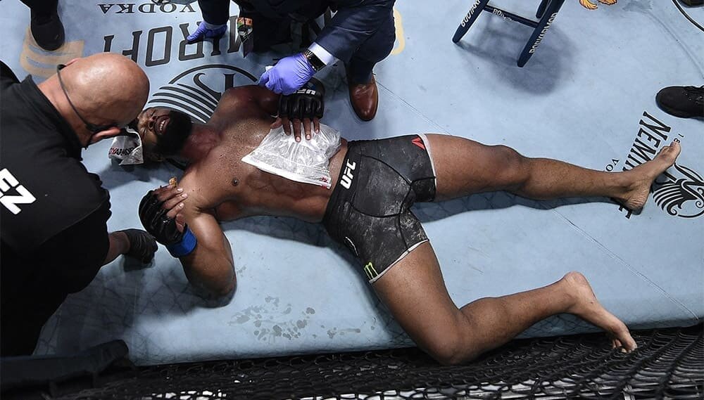 Бывший чемпион UFC в полусреднем весе, Тайрон Вудли, досрочно уступивший Колби Ковингтону на UFC Fight Night 178 в Лас-Вегасе, получил серьезную травму в концовке матча.