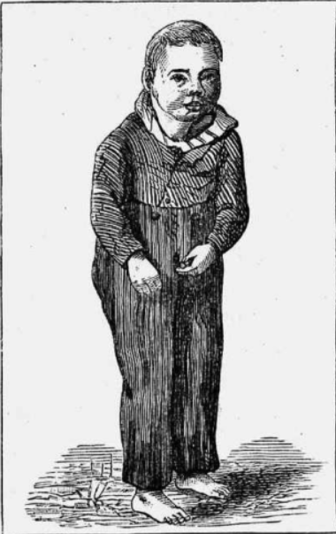 Иллюстрация из книги Д-ра Айрлэнда Идiотизм и тупоумiе Петербург 1880 г.