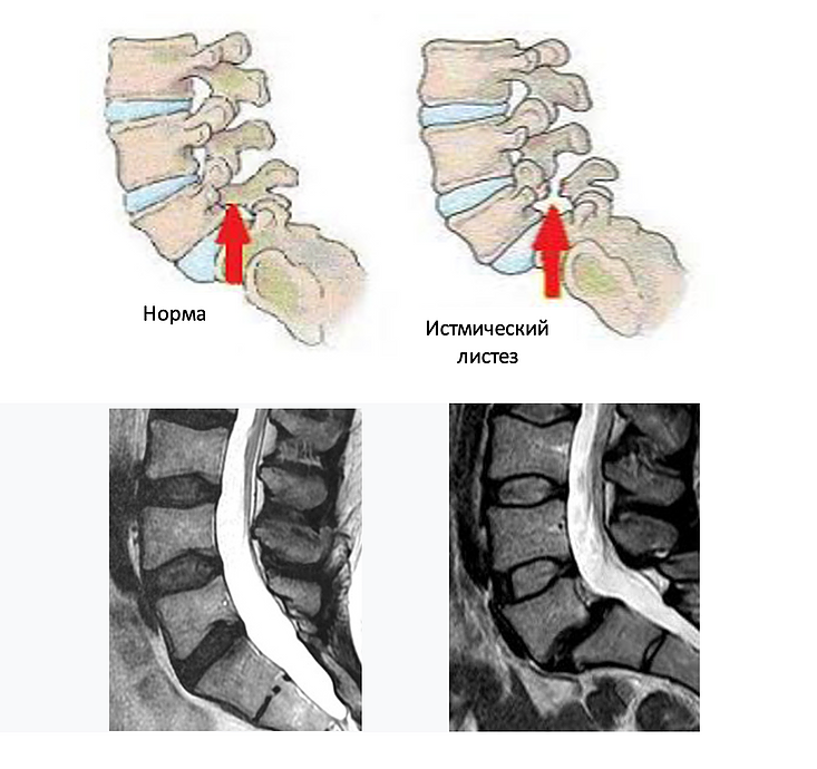 На картинке можно сразу понять, в чем проблема. 