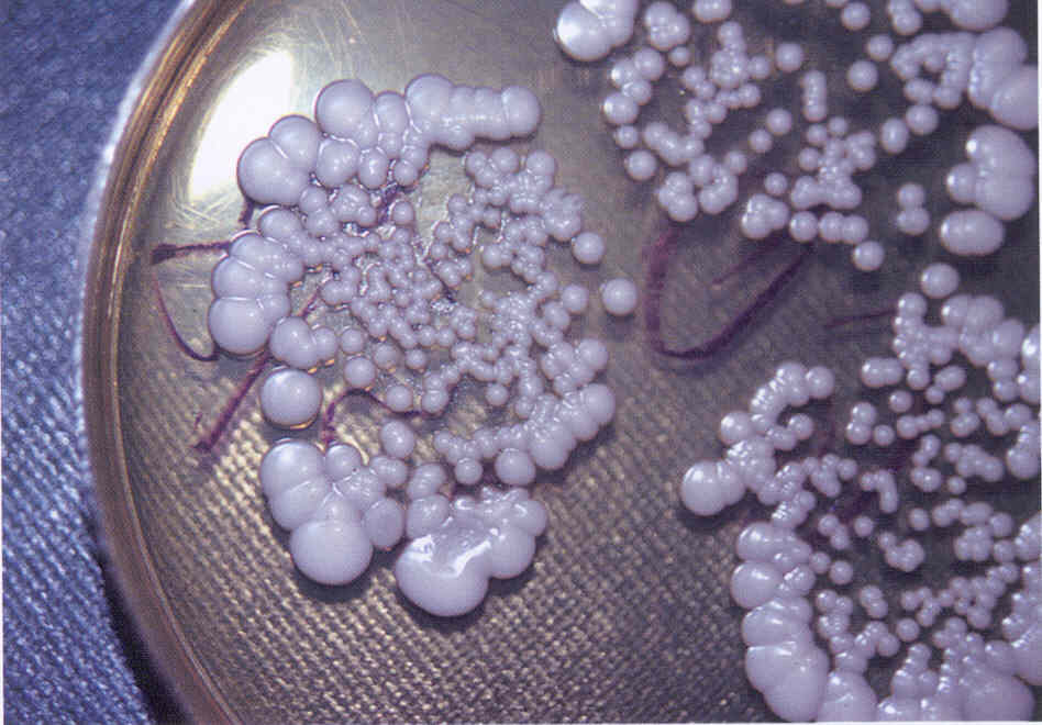 Одной из самых распространенных разновидностей грибковых инфекций, поражающих кожные покровы и слизистые оболочки, является кандидоз.