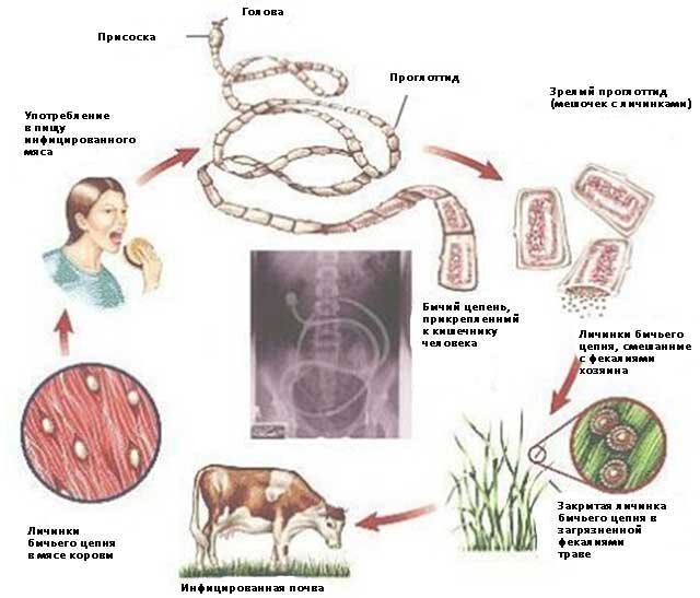 Тениидоз - Инфекции - Справочник MSD Версия для потребителей