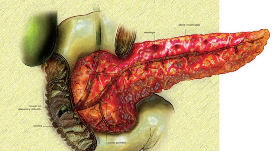 Поджелудочная железа здоровая и больная фото