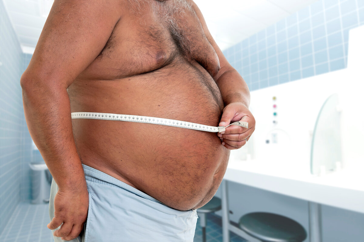 Ожирение большой живот