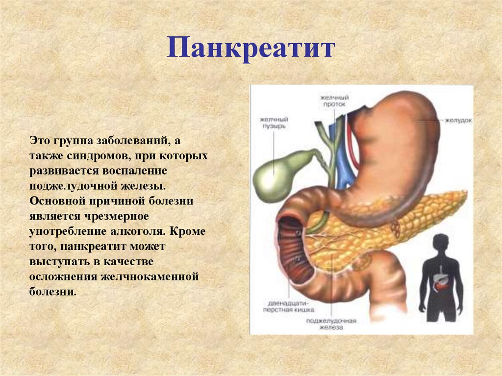 Кот поджелудочная. Гастрит, язвенная болезнь, панкреатит. Панкреатит поджелудочной железы.