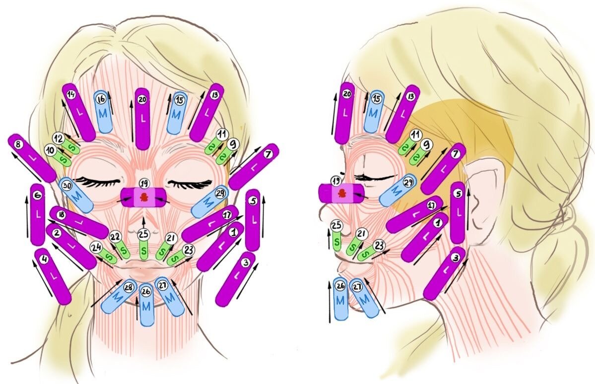 Схема тейпирования