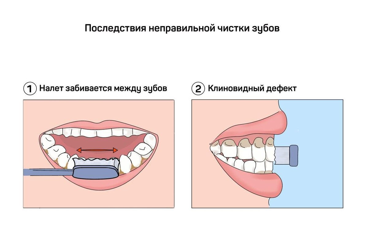 Как правильно чистить зубки? | Dr Anastasia. Всё о зубиках 🦷 | Дзен