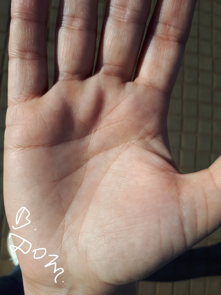 фото после коррекции жизни