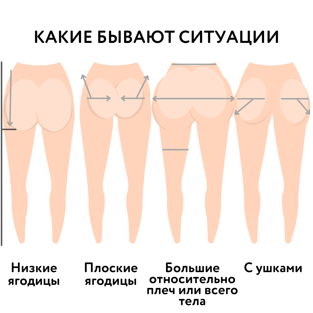 Как должна выглядеть попа