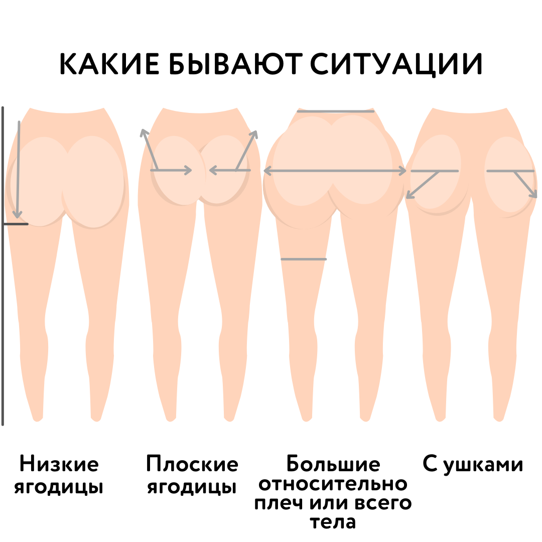 Способы увеличения ягодиц