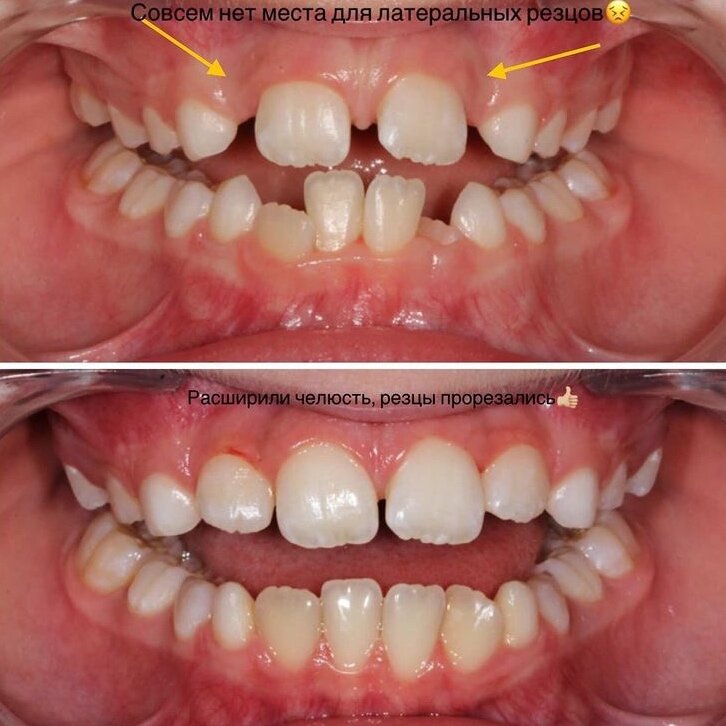 Как хорошо, что родители вовремя обратили внимание на проблему.