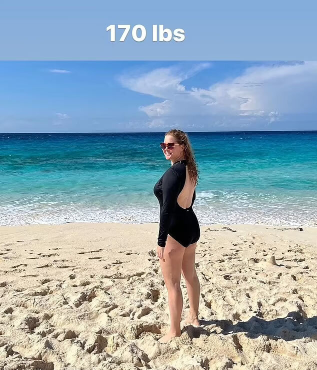 @amyschumer