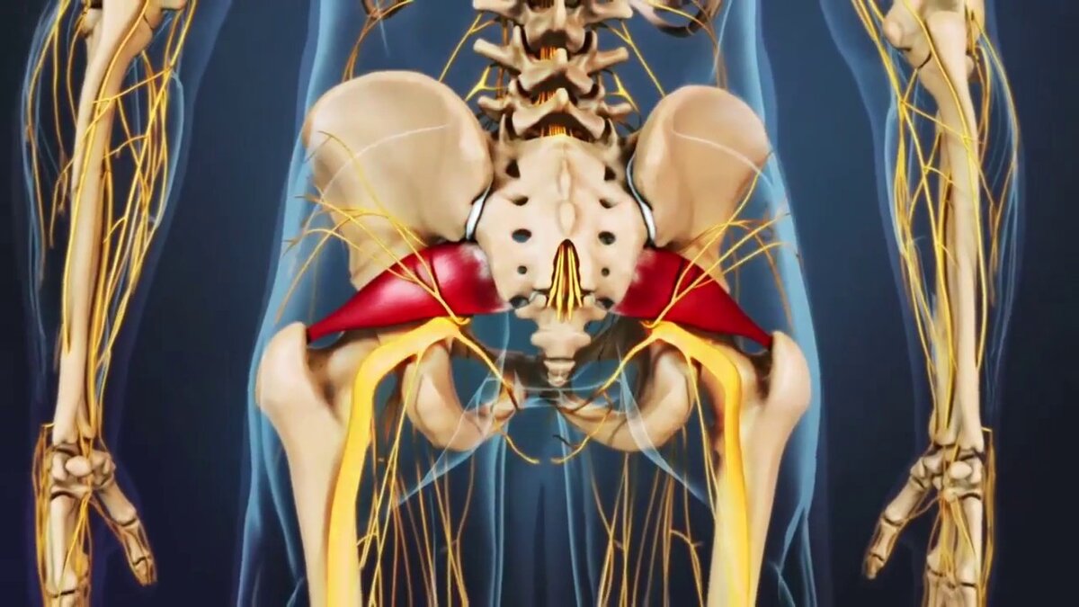 Грушевидная Piriformis