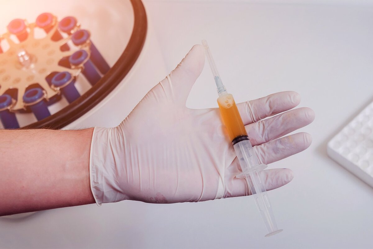 Кровь без плазмы. PRP терапия Platelet Rich Plasma. PRP шприц. Шприц с плазмой. Пробирка с плазмой.