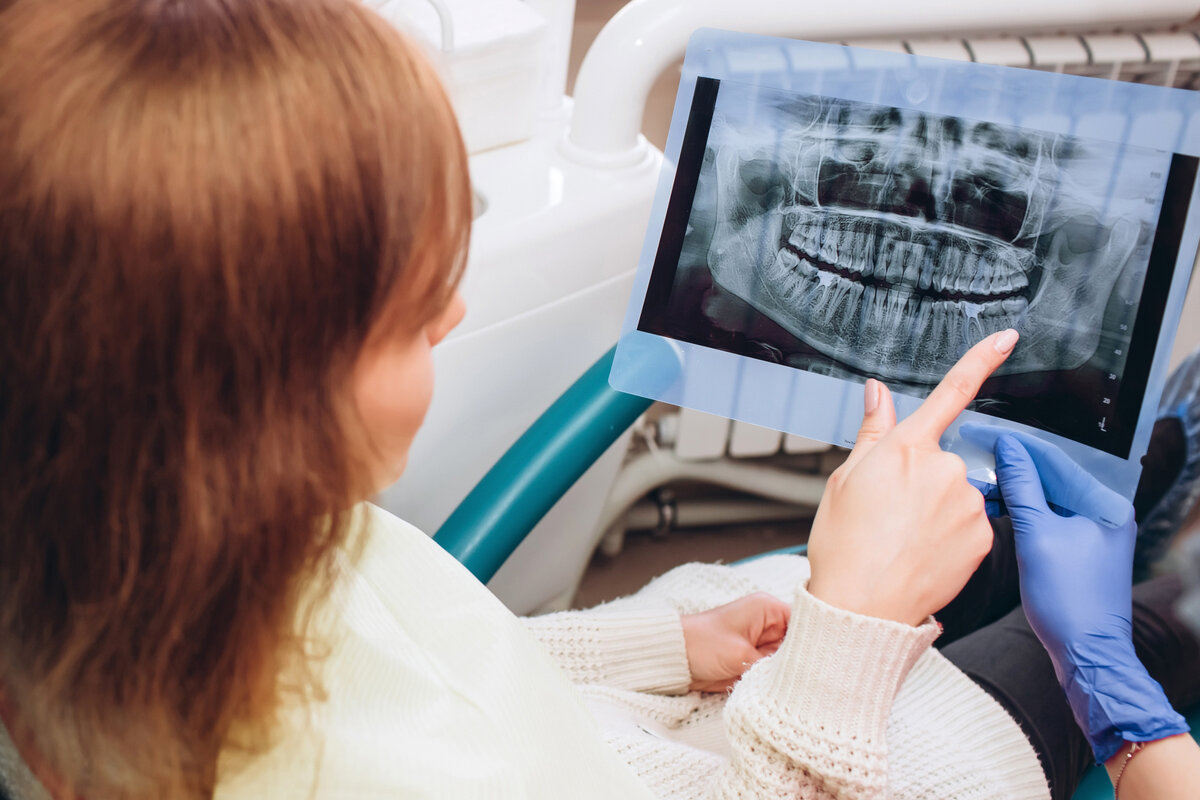 Виды рентгена в стоматологии - какие бывают? | Портал о зубах Симпладент |  Дзен