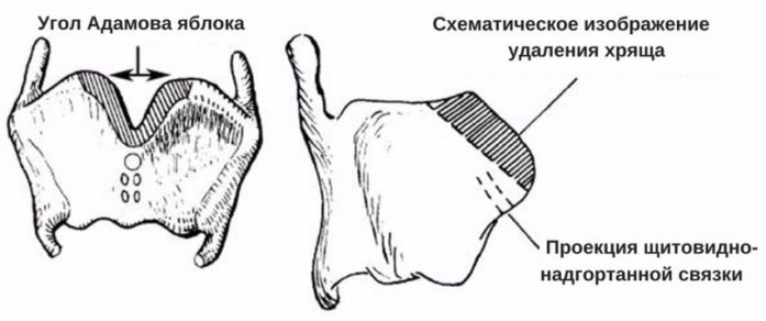 Трансгендерность — Википедия