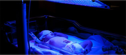 Фототерапия