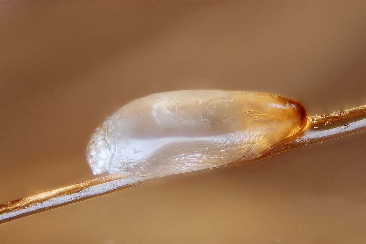 Педикулез – поражение кожи человека, которое вызвано паразитами – вшами. Я не знаю, где она их подцепила. Но примерно месяц назад начала жаловаться, что чешется затылок. Я никогда вшей и яиц их не видела. Посмотрела, ничего не нашла. А она продолжает жаловаться….
Однажды, выпросила покрасить ее, чуть светлее, чем есть. На это дело пришла бабушка, она у нас всех красит. Я попросила заодно и посмотреть наличие вошек. Бабуля увидела гниды!!  

Гниды — яйца вшей. Прикрепляются к волосам или одежде.

Для меня это проблема из проблем, особенно, когда первый раз сталкиваешься. Все эти обработки, вычесывания…
Но так как мы решили краситься, решили краска убьет их. Покрасили волосы, сверху промыли дополнительно разведенным раствором уксуса. И я села 2 часа вычесывать, снимать эти мелкие яички с волосиков.
Мы регулярно просматривали волосы неделю, потом расслабились.

И вот снова, подходит дочь и показывает что-то типа мошки. Я сразу смотрю ее затылок (на затылке теплее всего, поэтому вошки предпочитают это место), а там еще одна! Вошка! Ну и соответственно наличие их яичек.
И началось все заново….я начала подробно изучать эту тему. Поняла, что возможно не сняла всех в прошлый раз, и судя по инкубационному периоду 6-15 дней, это могли быть как раз те, вылупившиеся из гнид вошки.
Купили в магазине средство от вшей и гнид, которое «избавляет» за один раз. НЕ ВЕРЬТЕ! Не избавит за один раз. Промыли голову….запах атас, вызывает рвотный рефлекс (не все такие средства)…вычесывали час.
Но на просторах Интернета пишут, что как раз с гнидами такие средства не могут бороться и нужен «дополнительный бой». Из всех предложенных я выбрала уксус. Раствор из уксуса 70% должен быть в пропорции 1:16, а если уксус столовый 9% - то 1:2, 1 стакан уксуса и 2 воды. Аккуратнее, если сделать сильный раствор можно сжечь волосы и кожу.
В общем, на второй день мы нанесли этот раствор на голову, надели шапочку полиэтиленовую на 20 мин. Потом смыли и промыли шампунем. 30 минут вычесывания…
Сегодня третий день, и я опять буду сидеть и вычесывать, потому что, заплетая перед школой опять заметила одну гниду. Откуда они берутся??? Сил нет уже.  Думаю, может с разных сторон приклеиваются  мне не всегда видно…
Кроме того, поменяли всю постель. Перестирали одежду. 
Буду вычесывать две недели, весь инкубационный период. И раз в неделю делать уксусную маску для волос. Уверена победа будет за нами! 
