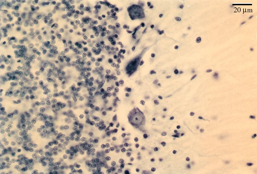 он же в 40-кратном