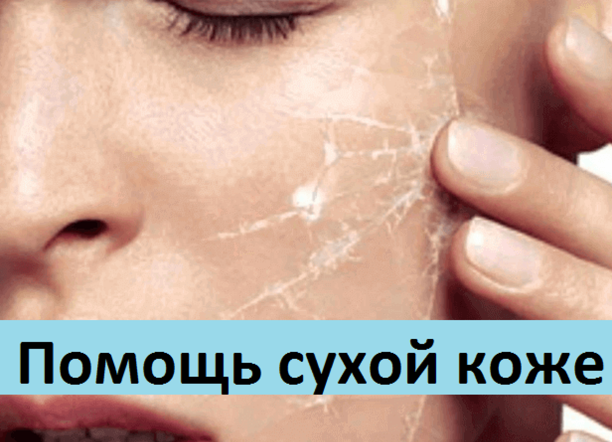 Помощь сухой коже