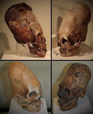 Находки удлинённых черепов в Перу