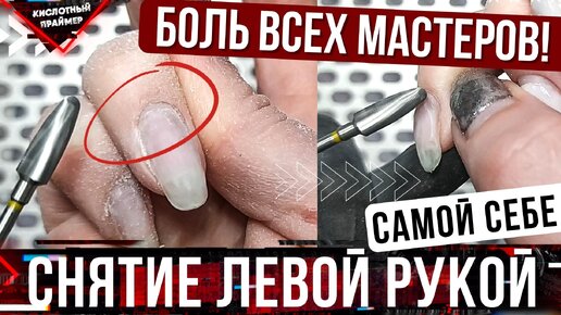 Что делать если сильно болит зуб? 10 способов снять острую зубную боль в домашних условиях