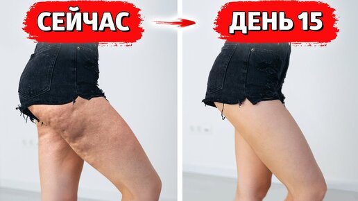 ЛУЧШИЕ ДОМАШНИЕ СПОСОБЫ, ЧТОБЫ УБРАТЬ ЦЕЛЛЮЛИТ