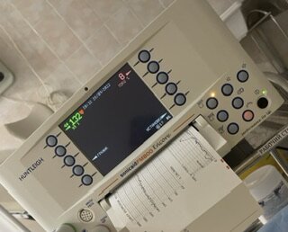 Ктг перед родами