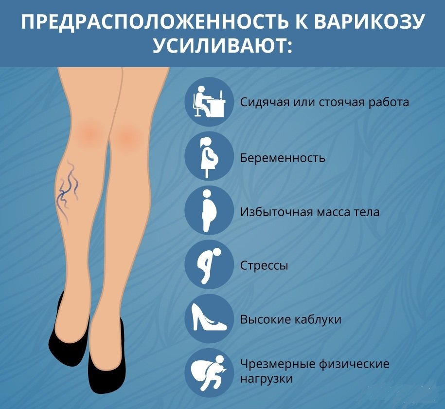 Предрасположенность к варикозу