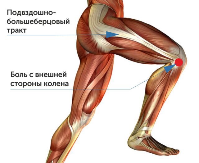 «Колено бегуна»: как диагностировать, лечить и не допустить травмы