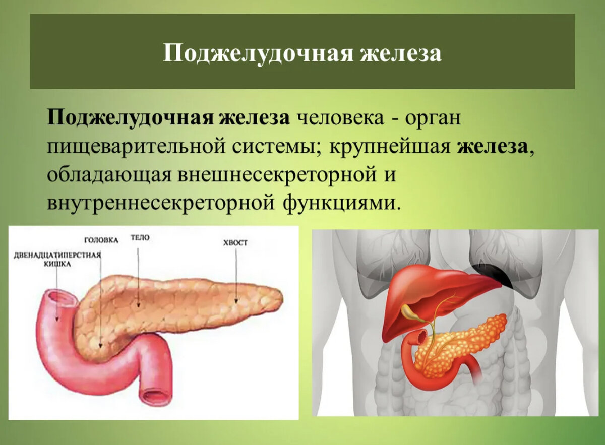 Рисунок поджелудочной железы человека. Воспаление поджелудочной железы. Аберрантная поджелудочная железа.